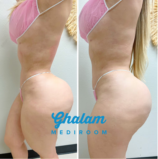 Ghalam Mediroom
