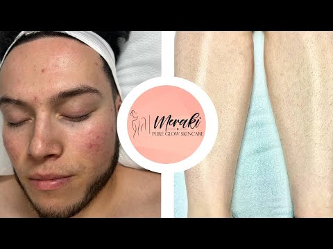 Merakiskinglow: Imagen vibrante de luces y colores para fondos digitales