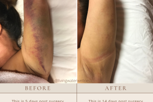 San Diego Lymphatics & Massage