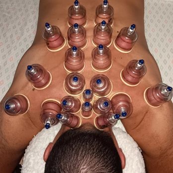 Masajes de Calidad en North County – Profesionales del Bienestar